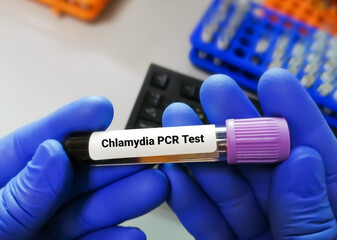 Poster - Chlamydia PCR test or  polymerase chain reaction for Chlamydia to detect STD