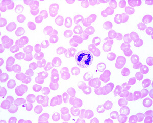 Poster - Human blood smear. Neutrophil