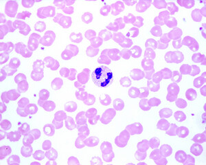 Poster - Human blood smear. Neutrophil