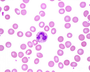 Wall Mural - Human blood smear. Neutrophil