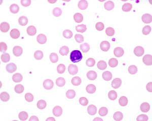 Poster - Human blood smear. Lymphocyte