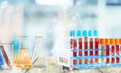 Poster - Science glass flask with extraction glassware set with blue chemical molecular structure in chemistry science lab.