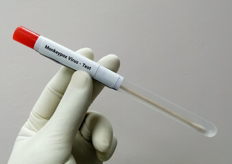 Poster - Vesicles fluid sample for Monkeypox virus test. It is also known as the Moneypox virus, a double-stranded DNA virus and member of Poxviridae family.