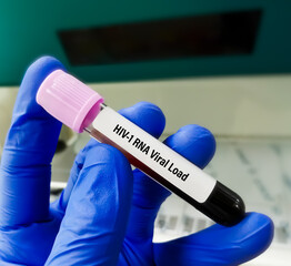 Sticker - Blood sample for HIV-1 RNA viral load test.