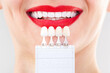 Perfect white smile red lips with shade guide bleach color tooth dental whitening, bleaching, quality control and color check at artificial dentition, crown veneer smile, dental care and stomatology