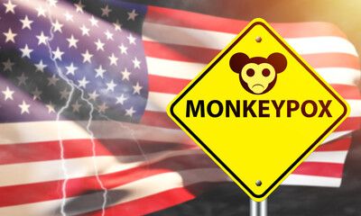 Wall Mural - Monkeypox in USA. Inscription monkeypox in front of flag of America. Smallpox cases in USA. Outbreak of monkeypox in United States of America. Monkey fever epidemic in US. 3d rendering.