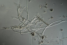 Mold Filaments And Spores