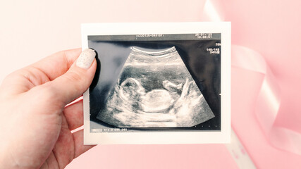 Ultrasound picture pregnant baby photo. Woman hands holding ultrasound pregnancy image on pink background. Concept of pregnancy, maternity, expectation for baby birth.