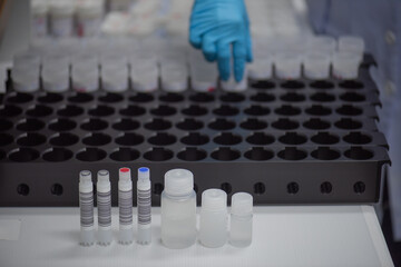 Reagent bottles are used for hospital laboratories.