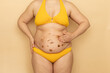 © Юля Бурмистрова - Fat woman in yellow swimsuit apply brown body cream on thick sagging stomach, beige background. Slimming, fighting overweight, obesity and cellulite. Plus size people and body positive concept.