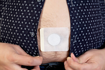 a man in a shirt glues a medical patch for chronic prostatitis on his navel. treatment of prostate a