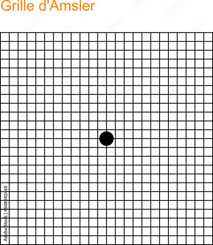 Amd Screening. Macular Degeneration Test. Vision control. Grid scotoma ...