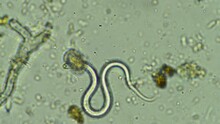 Nematodes Under The Microscope In Soil And Compost