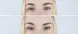 © Siniehina - Fox eye lift. Before and after. On left is a girl with normal eyes, and on right is after an imitation operation eyes look foxy. Concept of changing the appearance with threads or botulinum toxin.