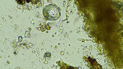 Sticker - soil microbes in a soil sample on a sustainable agricultural farm in australia