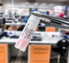 A cryovial containing frozen human cancer cells preserved in liquid nitrogen for research purposes.  