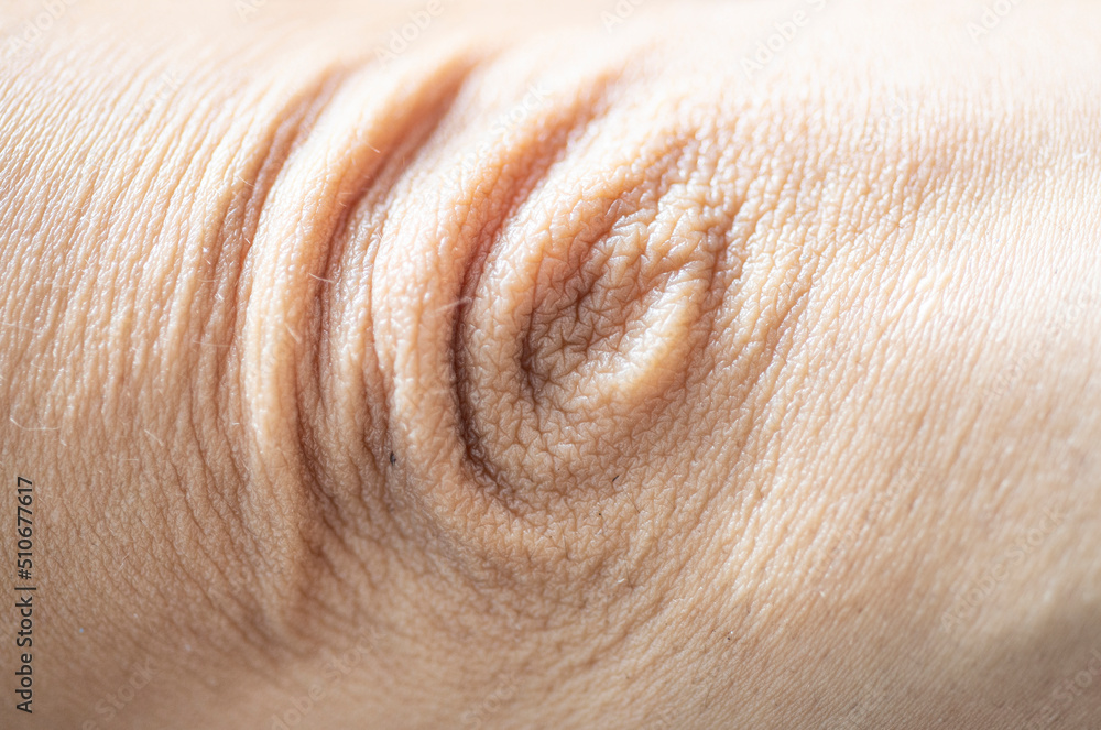 Picture of wrinkles on the skin of different parts of the human body.