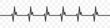 Heartbeat icon. Heart pulse on transparent background. Heart rhythm sign. Vector illustration.