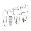Natural and artificial teeth line art on white isolated background