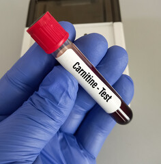 Poster - Scientist hold blood sample for Carnitine blood test, Carnitine helps the body convert fats into energy. Carnitine(total and free) test.