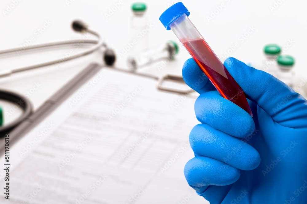 Blood sample tube for analysis of test in the laboratory. doctor ...