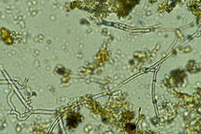 Soil Microbes Organisms In A Soil And Compost Sample, Fungus And Fungi And Under The Microscope In Regenerative Agriculture. In Australia.
