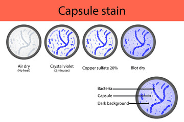 Wall Mural - Capsule staining microbiology lab technique steps diagram, using Crystal violet and copper sulfate vector illustration eps10