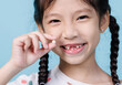 © DN6 - 7 Years old child has loose tooth, Dentistry and Health care concept