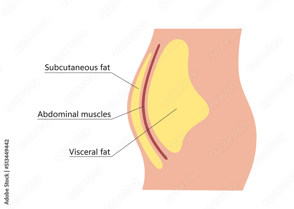 Visceral and subcutaneous fat around waistline. Location of visceral ...