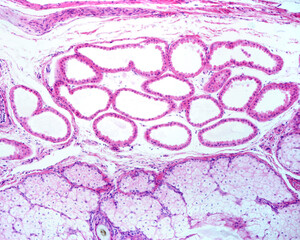 Poster - Apocrine sweat and sebaceous glands