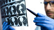 © Markoff - A male doctor examines a CT scan of a patient's lungs. Treatment of bronchitis, pneumonia, coronavirus. Close-up. Selective focus.