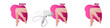 © Darina - vector leg epilation banner, female legs, smooth skin, layout with the result of the procedure, hardware cosmetology