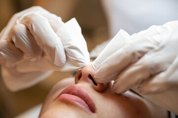 Wall Mural - Cleansing facial skin, beautician squeezed blackheads. Manual facial cleansing. Close up
