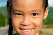 Healthy smiling face of a cute little girl with a sunburn on her face. Happy little Asian girl child showing front teeth with big smile and laughing. Beauty and health of the skin.