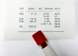 Canvas Print - Blood sample isolated for Lipid Profile test with abnormal report.