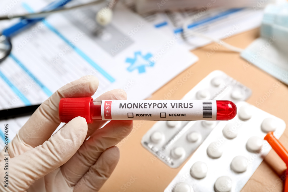 Female doctor with blood sample on beige background, closeup. Monkeypox virus concept
