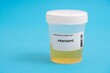 Fentanyl. Fentanyl toxicology screen urine tests for doping and drugs