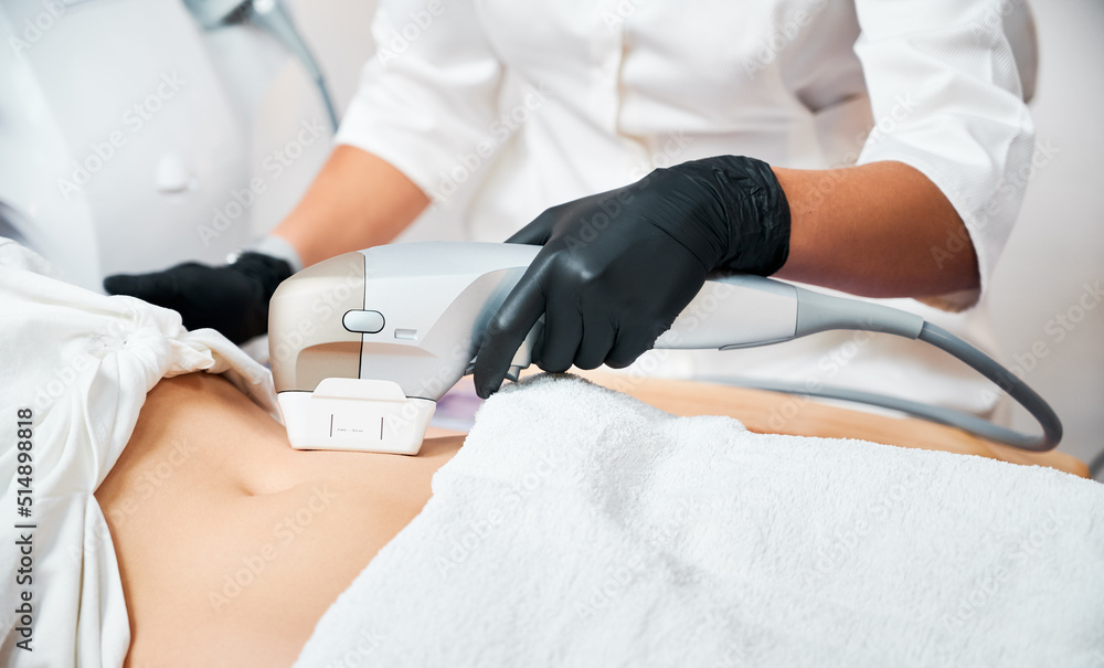 Close up view doctor's hands making non-invasive procedure of tightening abdomen skin, using sensor with micro-focused ultrasound spot heat layers of skin, up to musculoaponeurotic system SMAS.