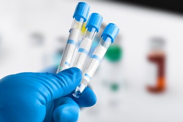 Wall Mural - Woman holding test tube with blood, health concept