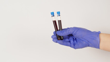 The hand is holding blood test tubes on white background. Hand wears a purple medical glove..