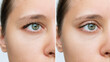 Cropped shot of a young caucasian woman's face with drooping upper eyelid before and after blepharoplasty isolated on white background. Result of plastic surgery. Changing the shape, cut of the eyes