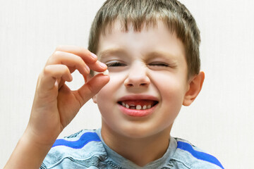 A cute child examines the first lost milk tooth holding it in his hand in front of his eyes. The boy squints and smiles with a hole in his mouth. Change of childrens teeth. Happy preschooler boy.