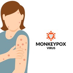 Vector illustration, woman exposed to monkeypox virus, as an educational poster or banner.