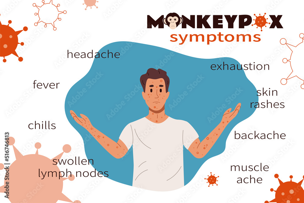 Curated visual reference: Cat Skin Rashes Due To Lymphoma Reference: Monkeypox Virus Symptoms Infographic Banner Male Patient With Headache