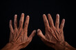 © photobc1 - the surface of the hand