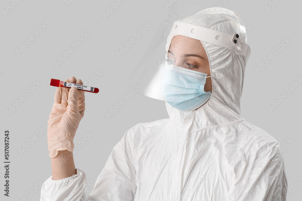 Scientist with sample of monkeypox virus on light background