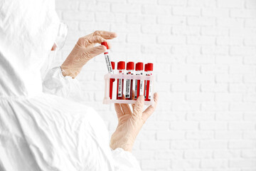 Wall Mural - Scientist with samples of monkeypox virus on white background