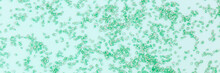 Bright Green Stones Are Scattered On A Turquoise Background. Banner.