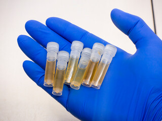 Sticker - Close-up, a set of test tubes with yellow vaccines is laid out in the hand of a scientist on a metal background