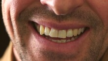 Oral Closeup Of Laughing Man With Yellow Teeth And Facial Hair. Headshot With Face Detail Of A Happy Smiling Male With Unshaved Chin And Cheeks Waiting For Whitening Treatment At The Dentist